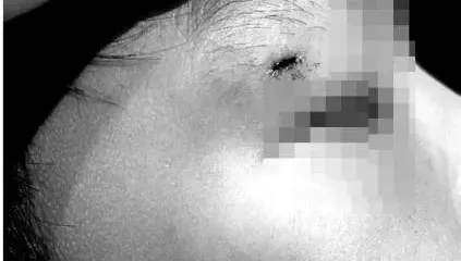 恐怖意外！宜蘭童玩節水戰車造成7歲孩童「眼角受傷」　縣府文化局回應了
