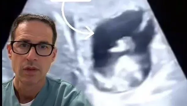 稀奇！33歲女腹痛停經卻出血　竟是「胎兒在肝臟」　全球文獻僅31例