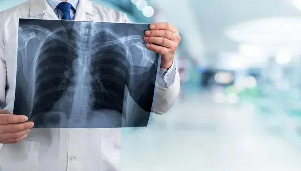 20多歲女罹肺腺癌！醫基因檢查發現：4大原因誘發