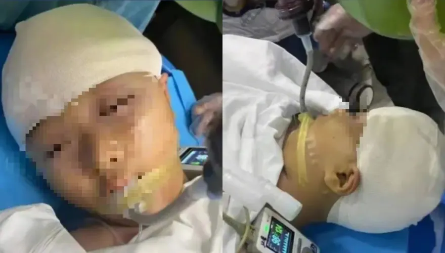 9歲女上課遭爆頭「插玻璃流腦漿」！男師竟先偷帶去縫合　開顱5小時命危