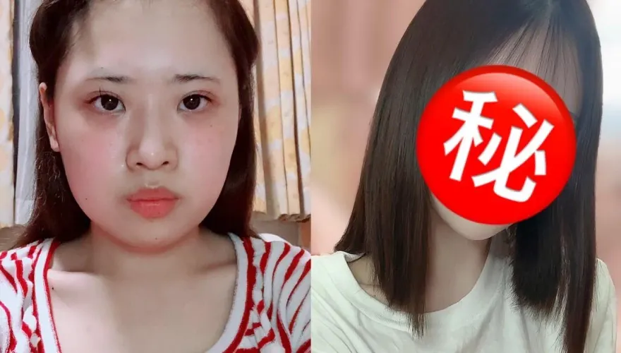 日本妹砸「超過173萬元」全臉大改造　整形前後對比照驚呆網：好可愛