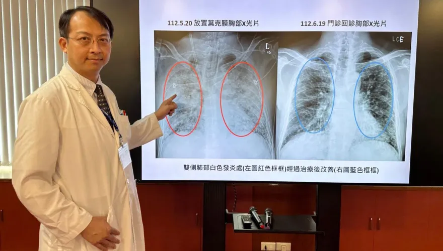 恐怖流感！64歲男呼吸困難變重症　中榮俯臥治療、葉克膜救命!