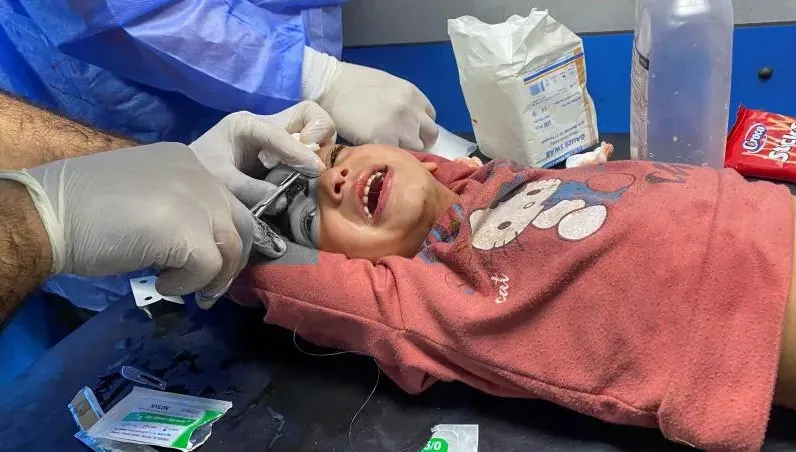 加薩麻藥短缺！女童縫額頭傷痛爆哭喊媽媽　有傷患咬紗布或背誦經文止痛