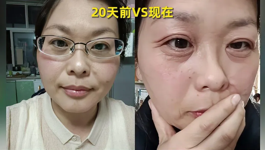 影/20天變7旬嬤？42歲OL曬素顏照稱遇「斷崖式衰老」　專家：男性更早出現