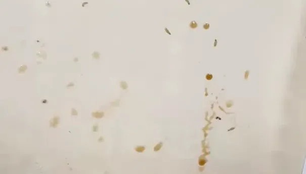 荷包蛋變「培養皿」！她開便當驚見噁心蛆蟲亂竄嚇壞　網友分析和「它」有關