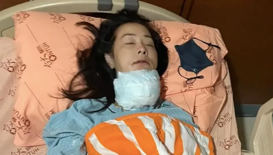 八點檔女星兵家綺罹患甲狀腺癌　開刀淋巴疑似驚見「腫瘤」...停工現況曝