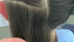 美髮師生涯最大挑戰？她幫女孩清頭皮　「一梳上百顆蟲卵」當場嚇傻