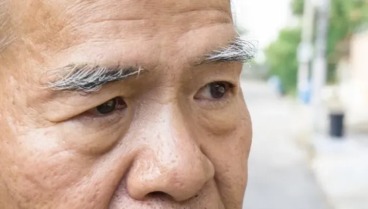 眉毛愈長愈長壽？醫坦言：50歲後眉毛變長小心「4健康隱憂」