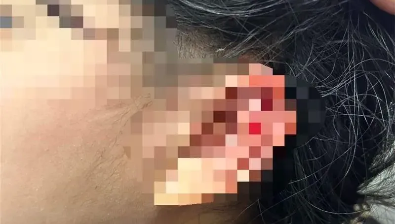 急尋目擊者！三峽少女遭橋下「向上射」沖天炮炸破耳膜　家屬發文緝「兇」