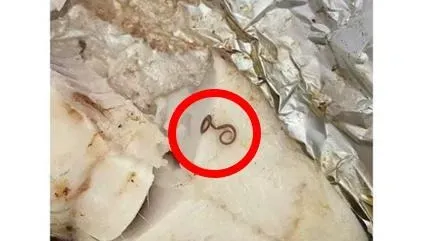 不是吻仔魚！超市黑鱈魚柳「驚見長條寄生蟲」　母為嬰做副食品險吃下肚