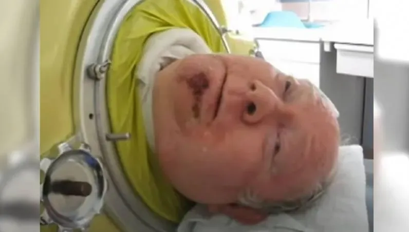 6歲患小兒麻痺「困鐵肺70年」還當上律師　美國傳奇男逝世享壽78歲