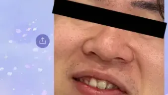 手殘傳男友露齒近照！LINE官方帳號無法收回　管理員義氣相挺不外流