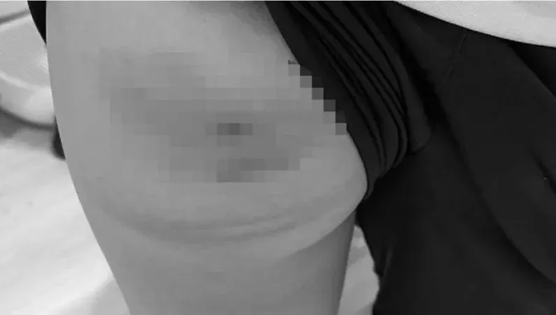 母見兒屁股一片瘀青氣炸喊告！北市國小教練爆「體罰9男童」這下慘了