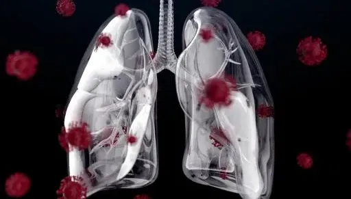 癌症快轉17秒！肺癌成為新癌王　醫：處理空氣污染不能等