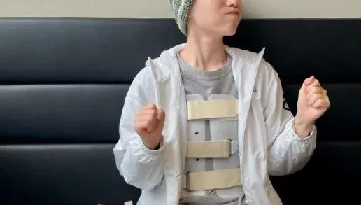 影/跌倒撞頭！美女空姐「左半邊頭蓋骨被削」  親曝病況引百萬人感動