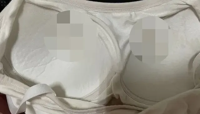 妹子內衣「兩點位置泛黃」！網友一看急勸就醫：可能是纖維囊腫