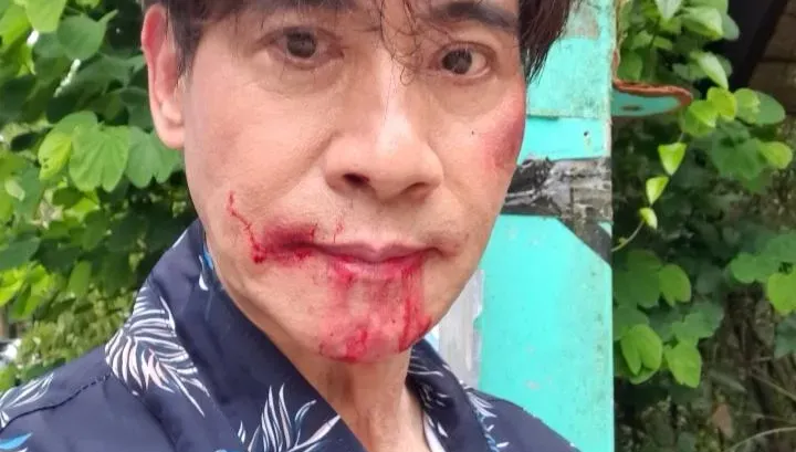 翁家明遭綁狼狽挨揍　滿臉是「血」畫面曝光！