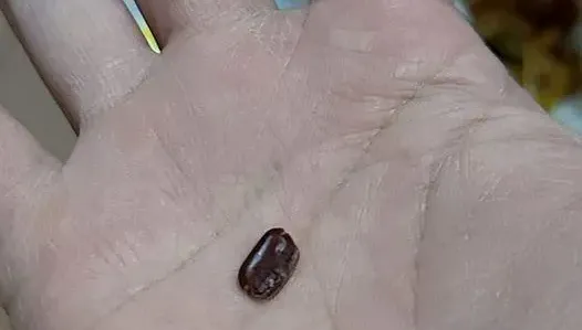 吃韭菜水餃「喀一下」！吐出來看竟是蟑螂蛋　網反胃：這嘴不能要了