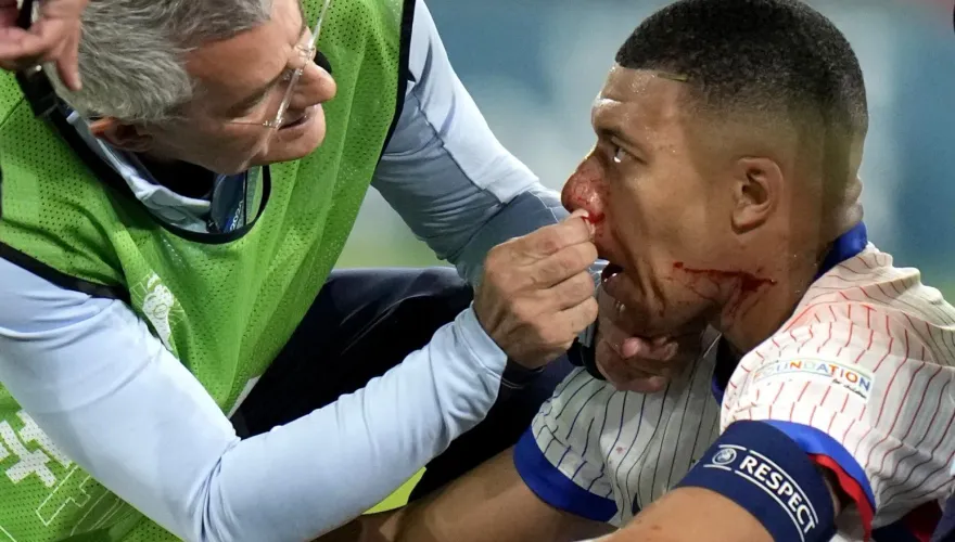 影/空中爭球相撞！姆巴佩「鼻血直流」骨折　歐國盃意外退場