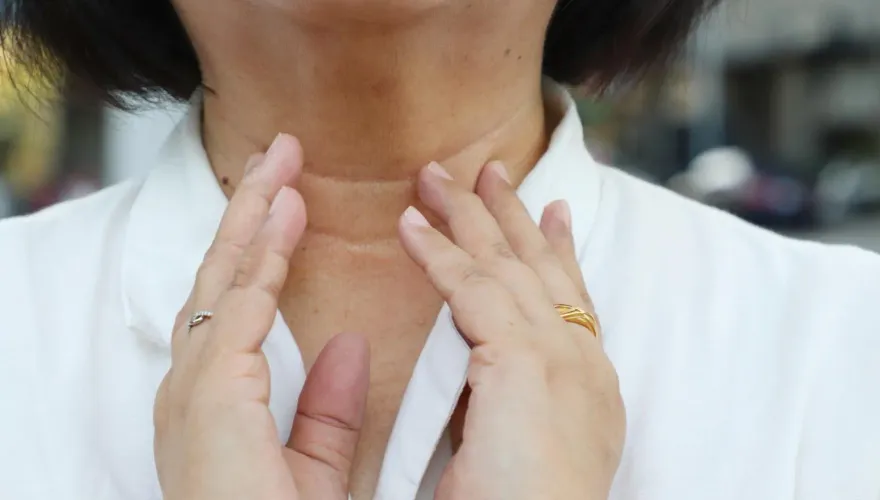 甲狀腺癌女性好發率排行第4！醫：「甲狀腺亢進」患者免擔心　可放心備孕