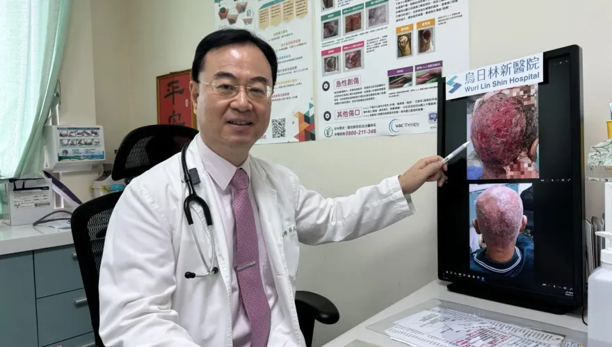影/驚！69歲男服用標靶藥物「頭皮整片潰爛」　醫：最嚴重等級併發症