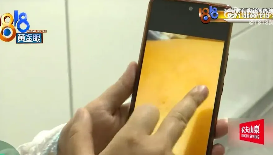 影/豆腐做的？被男同事「拍一下背」她1年沒上班　稱中「鐵砂掌」索賠18萬