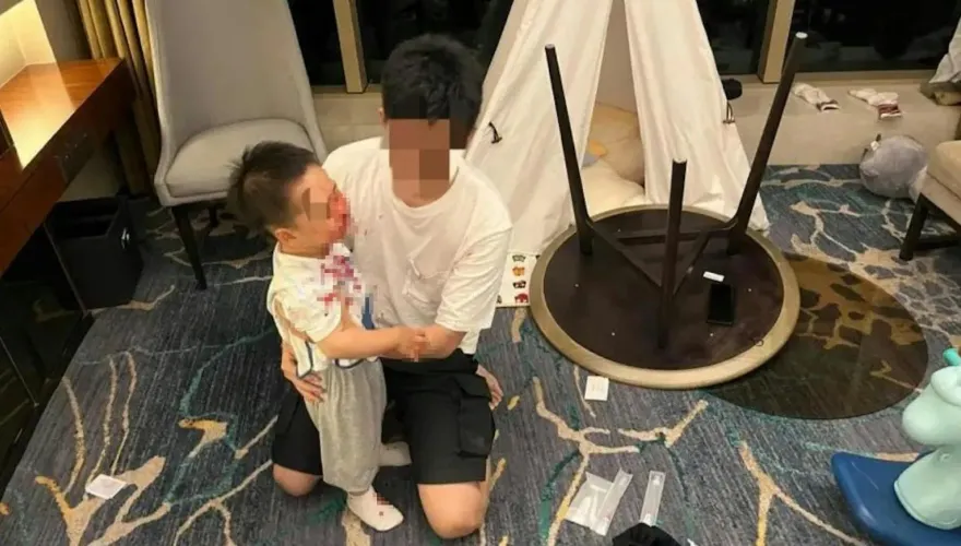 衣服都是血…2歲童被親子房圓桌砸中險毀容　上海五星級酒店：無安全隱患
