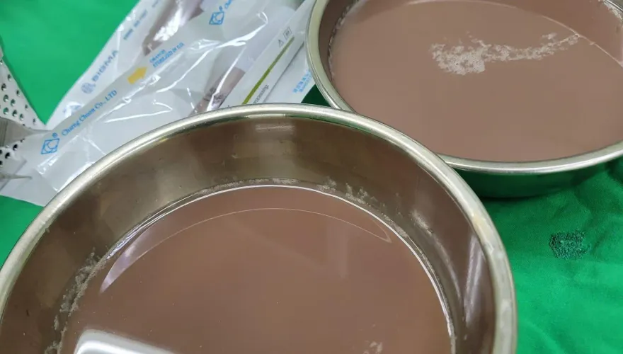 這不是奶茶！60歲男子血尿就醫引出1公升「奶茶尿」嚇傻　醫：嚴重腎水腫
