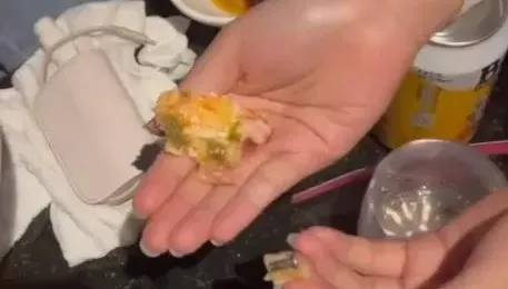 KTV點披薩竟「吃到螺絲釘」！她傻眼喊：牙齒超痛　業者回應了