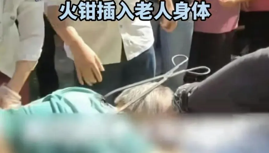 影/驚悚！8旬陸嬤路過工地...下一秒「背插火鉗」倒地亡　官方：高空作業失手