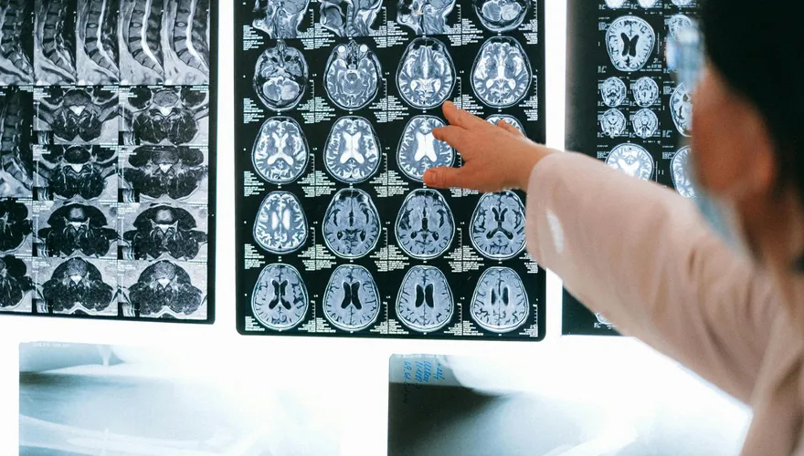 長輩步伐變小、記憶變差是失智？醫示警：恐是慢性水腦症