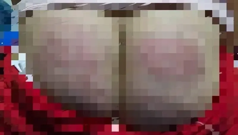 成長營遭爆虐童！「不求人」狠打手背+剩飯加辣椒逼吞完　雲林社會處不忍了
