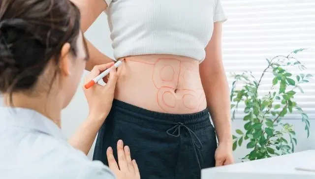 30歲女抽脂後3天昏迷！竟因「脂肪栓塞」　醫警告：致死率一半