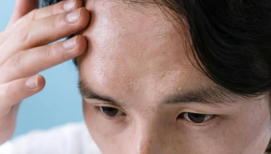 頭髮稀疏、滿臉痘痘恐是糖尿病徵兆！醫示警：超過3項快檢查