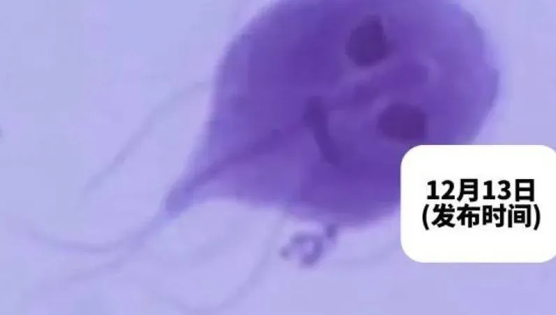 陸男瘋狂腹瀉2週！糞便中驚見「鬼臉」　疑寵物感染寄生蟲