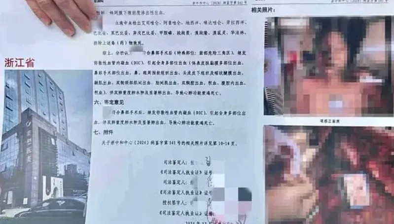 醫美出人命！浙江21歲妙齡女隆鼻猝死　出事診所涉27起官司仍執業