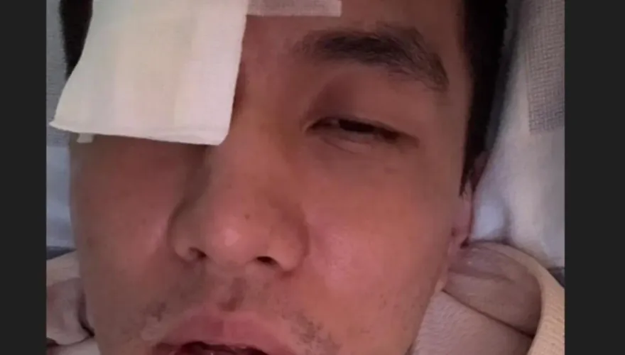 遭「手插眼球」致結膜破碎！陸球星PO血照痛訴：瞎了就不活了