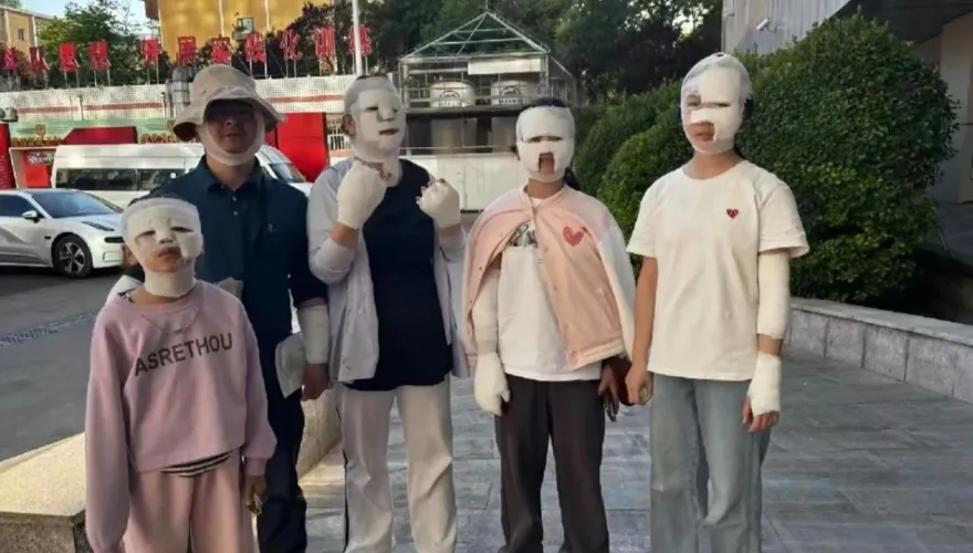 影/卡式爐烤肉突爆炸！北京7人被炸傷慘變「木乃伊」