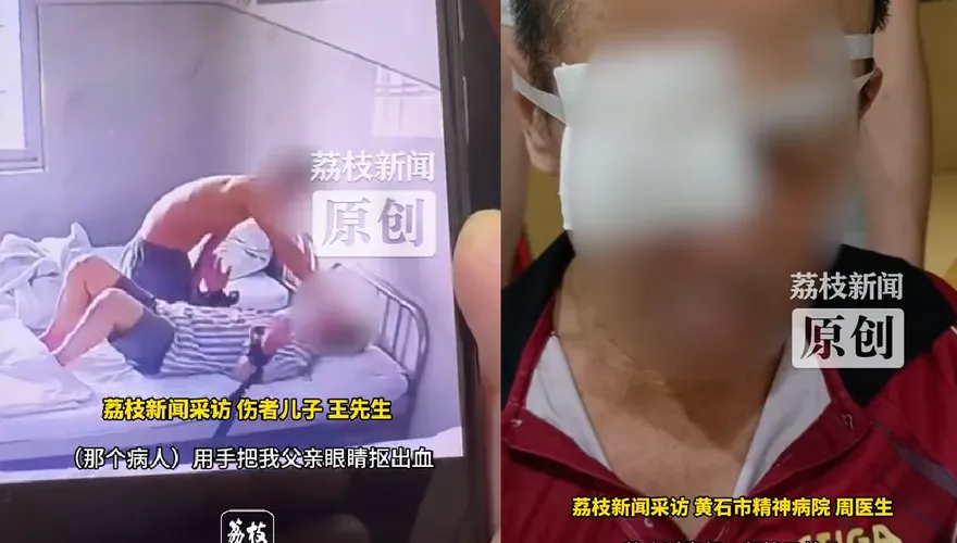 陸翁住院遭精神病友「摳出眼球」失明　兒崩潰：父雙手被綁