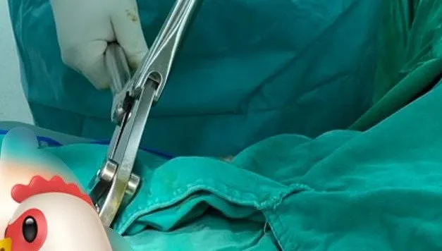 玩過頭！「延時環」卡死命根…腫成象拔蚌　險釀組織壞死