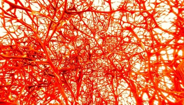 血栓在腳、栓塞衝腦！醫示警「三高久坐族」更要小心