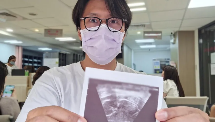 張啟樂當爸了！曬超音波照　嗨喊愛妻懷孕是「意外驚喜」