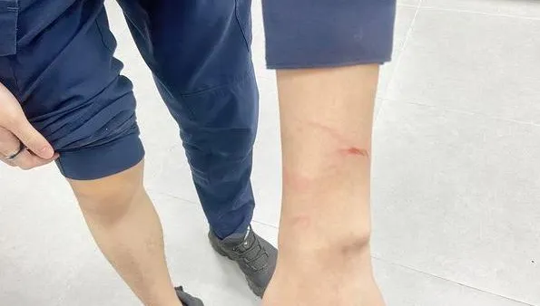 桃園逆子酒後砍父又咬傷員警　4罪名起訴