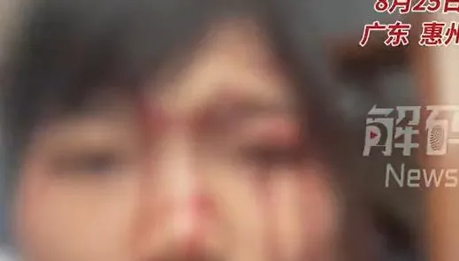 嚇！陸女問同事「訂金怎麼退」對方突抓狂　遭馬克杯狠砸頭噴血