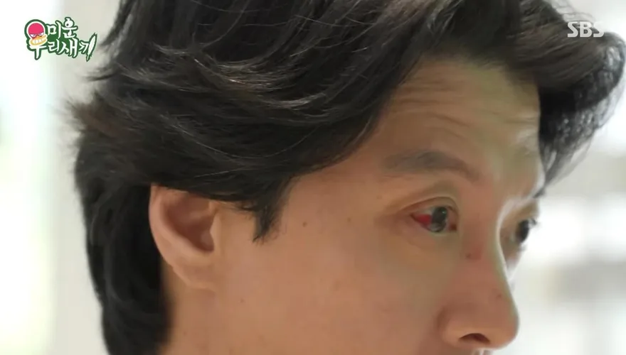 李東健罹罕病！右眼充血、呼吸劇痛折磨全身　每月發作1次
