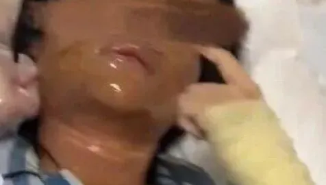 悚！陸美女主播家門口取包裹　竟是「包裹炸彈」慘炸毀容