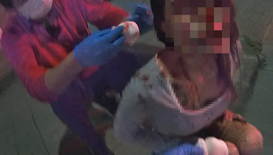 影/嘉義自撞車頭全毀3傷　後座19歲正妹頭破滿臉血