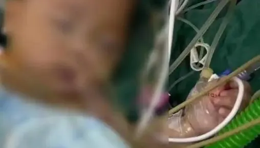 醫療疏失釀悲劇！陸5月齡女嬰術後離世　屍檢揭傷口未處理引關注
