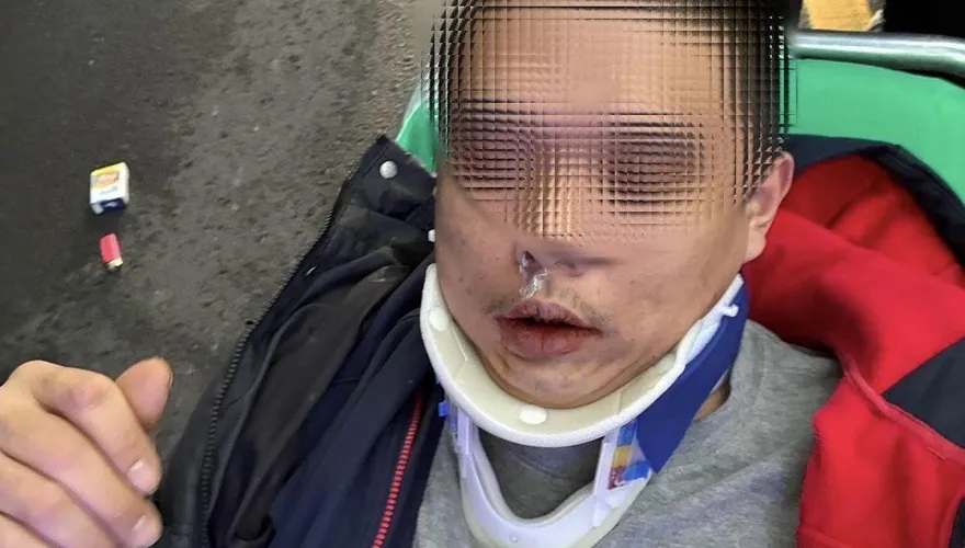 影/淡水男毒駕騎機車自摔　口鼻白色粉末露餡