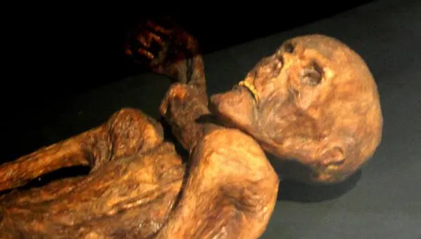 5300年前木乃伊就有性病？「冰人奧茲」驗出HPV致癌病毒